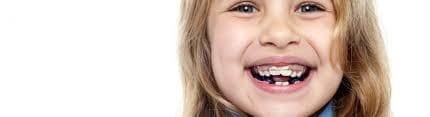 Orthodontics - it is never too early to start Orthodontics - it is never too early to start
